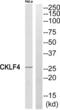 CKLF Like MARVEL Transmembrane Domain Containing 4 antibody, abx014368, Abbexa, Western Blot image 