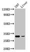 Ammonium transporter Rh type C antibody, LS-C673814, Lifespan Biosciences, Western Blot image 