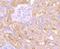 VPS26, Retromer Complex Component A antibody, A03951-1, Boster Biological Technology, Immunohistochemistry paraffin image 