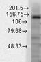 Potassium channel subfamily T member 1 antibody, GTX42002, GeneTex, Western Blot image 