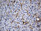 Chromosome 9 Open Reading Frame 43 antibody, M18370, Boster Biological Technology, Immunohistochemistry paraffin image 