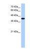 AKAP-7 isoform gamma antibody, NBP1-53116, Novus Biologicals, Western Blot image 