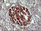 Phospholipid Phosphatase 1 antibody, LS-C788329, Lifespan Biosciences, Immunohistochemistry paraffin image 