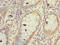 F-Box And WD Repeat Domain Containing 10 antibody, LS-C377786, Lifespan Biosciences, Immunohistochemistry paraffin image 