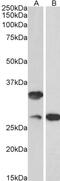 U6 snRNA phosphodiesterase antibody, PA5-37975, Invitrogen Antibodies, Western Blot image 