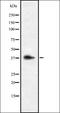 Serine/threonine-protein kinase ICK antibody, orb337535, Biorbyt, Western Blot image 