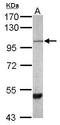 Paraplegin antibody, TA308134, Origene, Western Blot image 