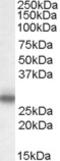 Myelin Protein Zero antibody, TA303265, Origene, Western Blot image 