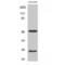 Lecithin Retinol Acyltransferase antibody, LS-C384366, Lifespan Biosciences, Western Blot image 