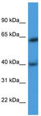Actin Related Protein T3 antibody, TA342882, Origene, Western Blot image 