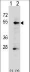 Alkaline Phosphatase, Placental antibody, LS-C156296, Lifespan Biosciences, Western Blot image 