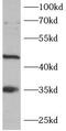 KIT Ligand antibody, FNab10327, FineTest, Western Blot image 