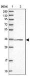 Family With Sequence Similarity 98 Member C antibody, NBP1-93753, Novus Biologicals, Western Blot image 