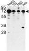 Phosphatase And Actin Regulator 2 antibody, GTX81354, GeneTex, Western Blot image 