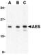 Amino-terminal enhancer of split antibody, MBS150968, MyBioSource, Western Blot image 