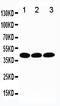 TATA-Box Binding Protein antibody, PA1534, Boster Biological Technology, Western Blot image 