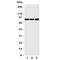 Neurotrophic Receptor Tyrosine Kinase 1 antibody, R31268, NSJ Bioreagents, Western Blot image 