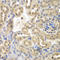Sulfotransferase family cytosolic 2B member 1 antibody, A05748, Boster Biological Technology, Immunohistochemistry paraffin image 
