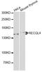 ATP-dependent DNA helicase Q4 antibody, A6846, ABclonal Technology, Western Blot image 