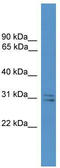 Synaptosomal-associated protein 29 antibody, TA342641, Origene, Western Blot image 