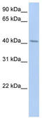 ER Lipid Raft Associated 1 antibody, TA341840, Origene, Western Blot image 