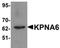 Karyopherin Subunit Alpha 6 antibody, orb75501, Biorbyt, Western Blot image 