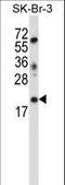 Lin-52 DREAM MuvB Core Complex Component antibody, LS-C165783, Lifespan Biosciences, Western Blot image 