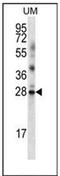 LRRN4 C-Terminal Like antibody, AP52548PU-N, Origene, Western Blot image 