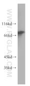 Kntc2 antibody, 18932-1-AP, Proteintech Group, Western Blot image 