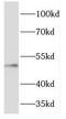Four-Jointed Box Kinase 1 antibody, FNab03133, FineTest, Western Blot image 