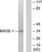 MAGE Family Member A1 antibody, TA312178, Origene, Western Blot image 