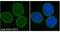 Spectrin Repeat Containing Nuclear Envelope Protein 2 antibody, MA5-18075, Invitrogen Antibodies, Immunofluorescence image 