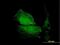 Tropomodulin 1 antibody, H00007111-B01P, Novus Biologicals, Immunofluorescence image 