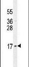 LLP Homolog, Long-Term Synaptic Facilitation Factor antibody, PA5-24329, Invitrogen Antibodies, Western Blot image 
