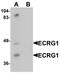 Transmembrane Serine Protease 11A antibody, orb178886, Biorbyt, Western Blot image 