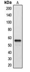 Cytochrome P450 Family 2 Subfamily A Member 7 antibody, MBS820809, MyBioSource, Western Blot image 