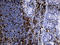 CD5 Molecule antibody, LS-C796669, Lifespan Biosciences, Immunohistochemistry paraffin image 
