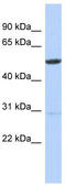 Zinc Finger Protein 529 antibody, TA345310, Origene, Western Blot image 