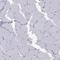 Neuronal Differentiation 6 antibody, HPA074530, Atlas Antibodies, Immunohistochemistry paraffin image 