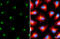 Polypeptide N-acetylgalactosaminyltransferase 2 antibody, GTX104070, GeneTex, Immunofluorescence image 