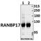Ran-binding protein 17 antibody, GTX66825, GeneTex, Western Blot image 