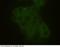 ERBB2 antibody, 10004-MM07-F, Sino Biological, Immunohistochemistry frozen image 