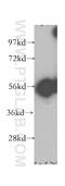 Glycerate Kinase antibody, 12426-1-AP, Proteintech Group, Western Blot image 