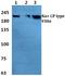 Sodium Voltage-Gated Channel Alpha Subunit 8 antibody, A02015, Boster Biological Technology, Western Blot image 