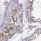 Dynein Axonemal Assembly Factor 1 antibody, NBP2-62685, Novus Biologicals, Immunohistochemistry paraffin image 