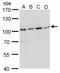 DNA Cross-Link Repair 1C antibody, GTX100128, GeneTex, Western Blot image 
