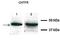 Ciliary neurotrophic factor receptor subunit alpha antibody, orb331079, Biorbyt, Western Blot image 
