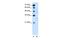 Solute Carrier Family 36 Member 3 antibody, PA5-42528, Invitrogen Antibodies, Western Blot image 