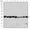 Cyclin Dependent Kinase 1 antibody, STJ97947, St John