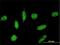 TOP1 Binding Arginine/Serine Rich Protein antibody, H00010210-M02, Novus Biologicals, Immunofluorescence image 